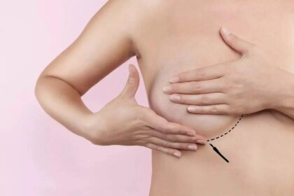 Breast Lift In Dubai