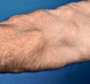 dermatology Orange CA