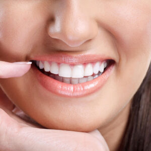 teeth whitening services