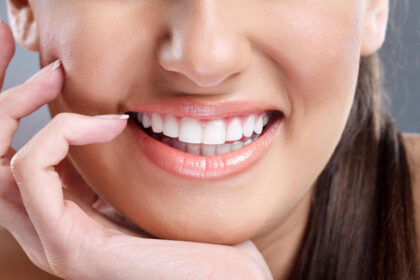 teeth whitening services