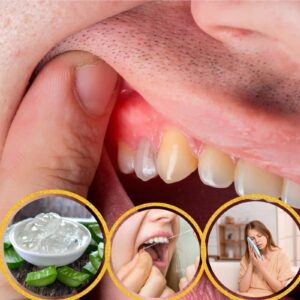 Heal Swollen Gums