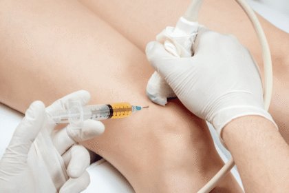 Pain-Free Knees with PRP Injections