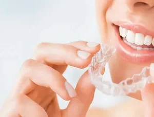 Aligners