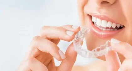 Aligners